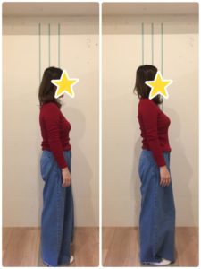 京都市 中京区 四条大宮 藤枝整骨院 30代女性 施術例