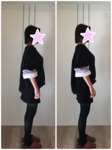 京都市 中京区　藤枝整骨院 20代女性　姿勢矯正の施術例