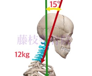 京都市中京区四条大宮　藤枝整骨院　右側面から頭頸部と胸部の上部の骨格を見た図で頭部の角度を15℃、それによってかかる負担を12㎏としています