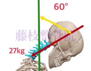 京都市中京区四条大宮　藤枝整骨院　右側面から頭頸部と胸部の上部の骨格を見た図で頭部の角度を60℃、それによってかかる負担を27㎏としています